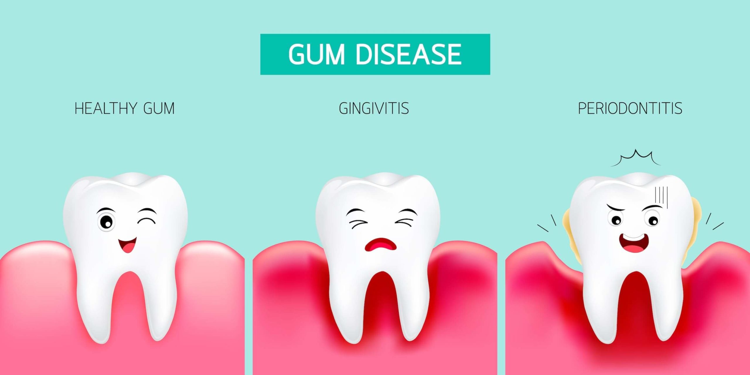 Progression of gum disease