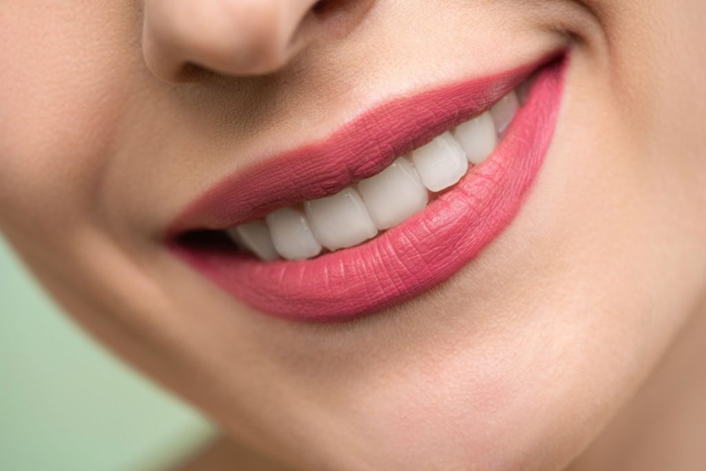 Smile makeover: What to Expect