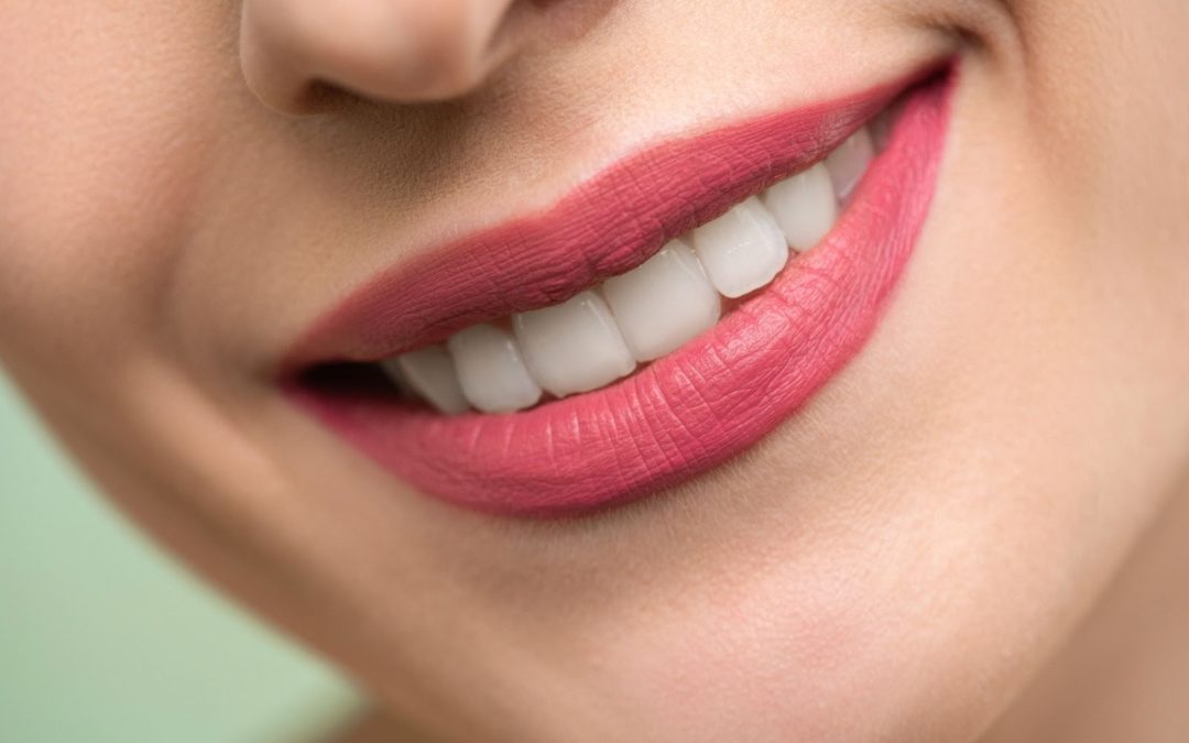 Smile Makeover: What to Expect